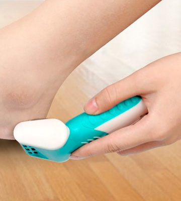 Review of O'vinna Safe, Practical and Easy Callus Remover