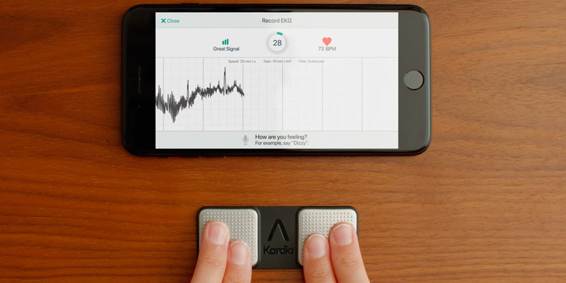 Review of AliveCor KardiaMobile EKG Monitor
